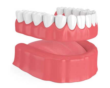 Removable Complete Denture